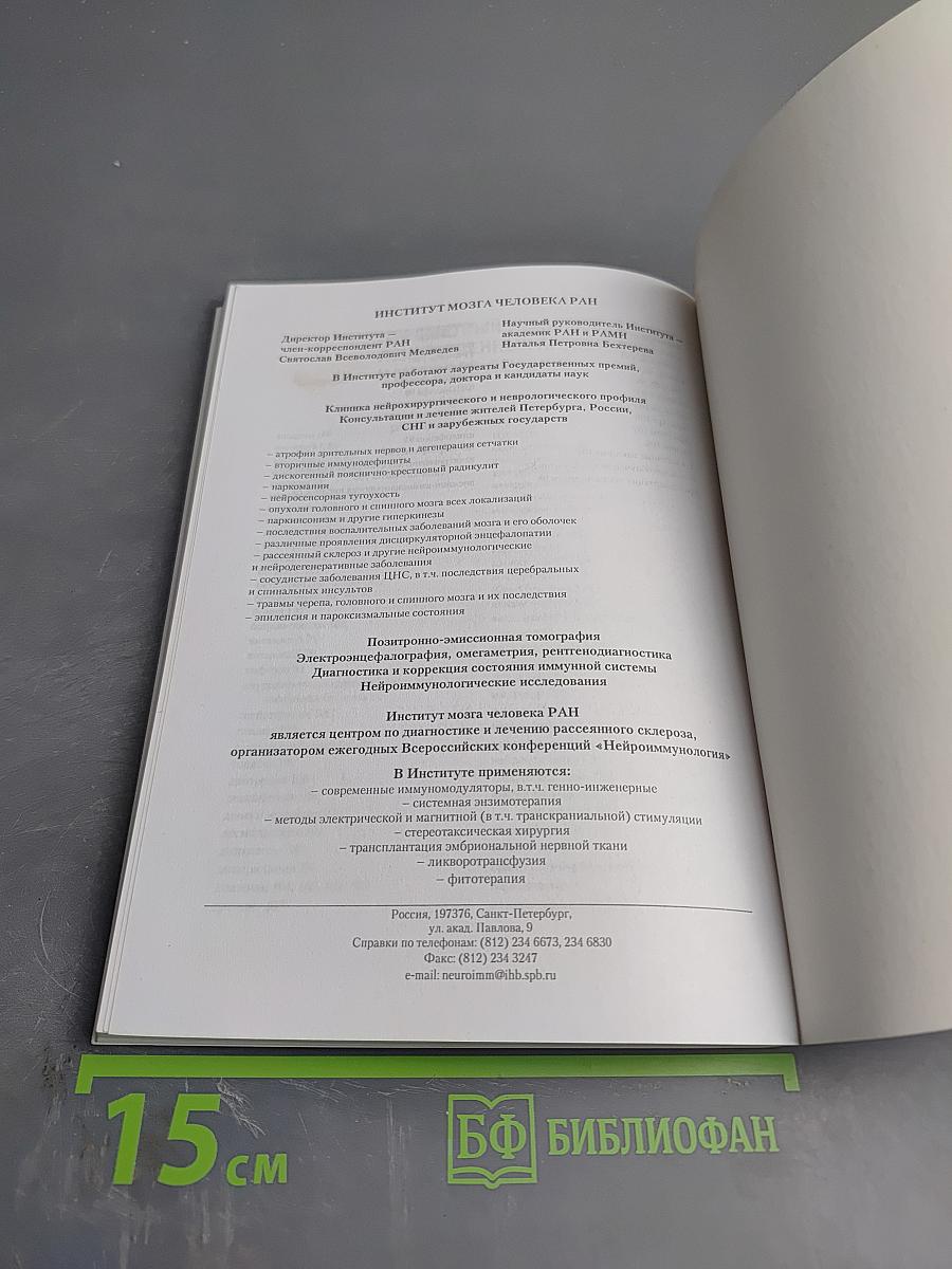 Рассеянный склероз