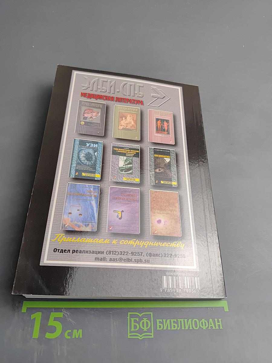 Рассеянный склероз