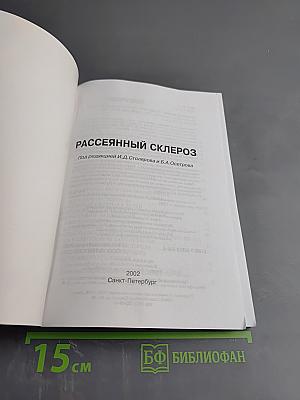 Рассеянный склероз