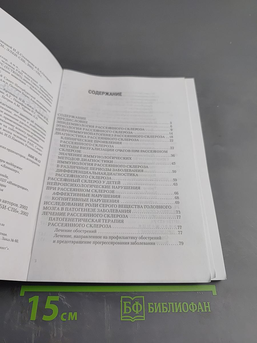 Рассеянный склероз