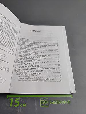 Рассеянный склероз