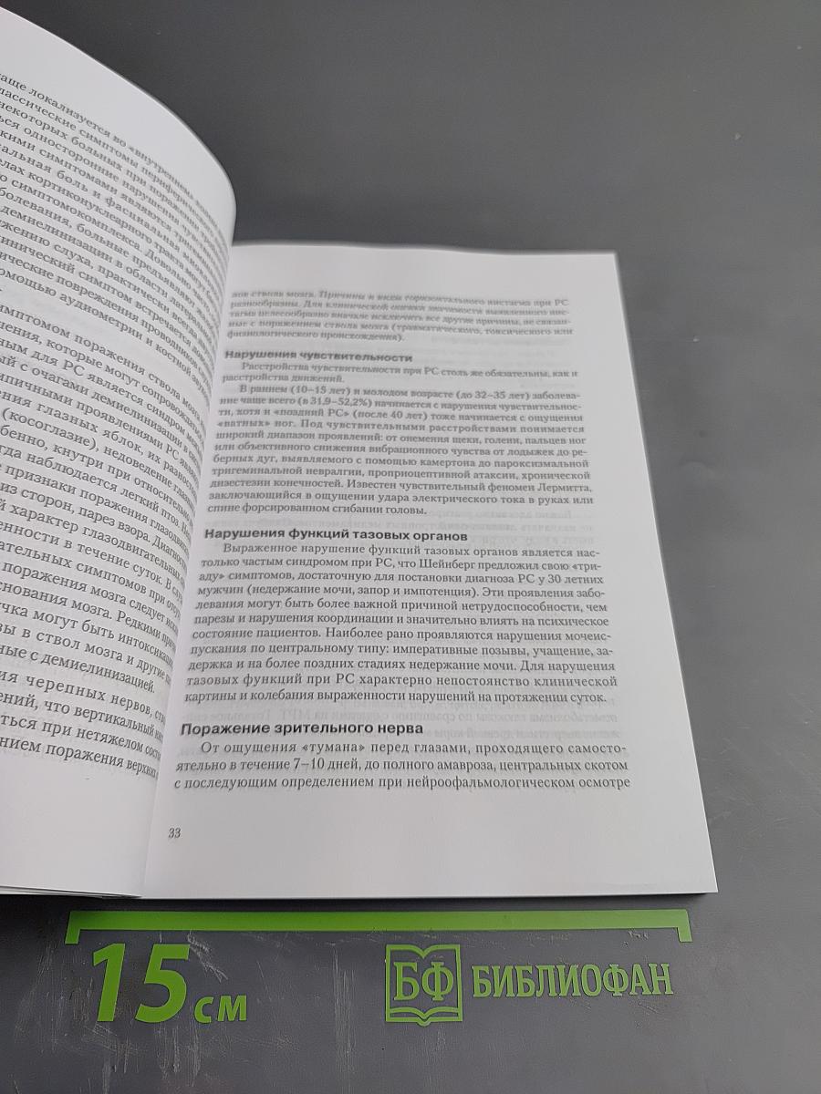 Рассеянный склероз