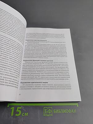 Рассеянный склероз