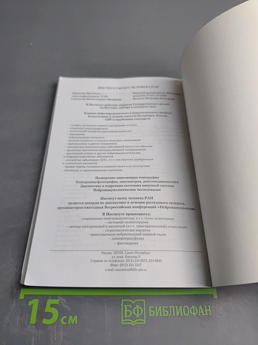 Рассеянный склероз