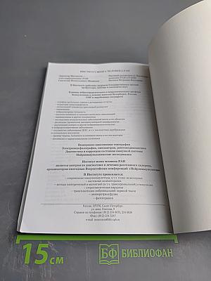 Рассеянный склероз