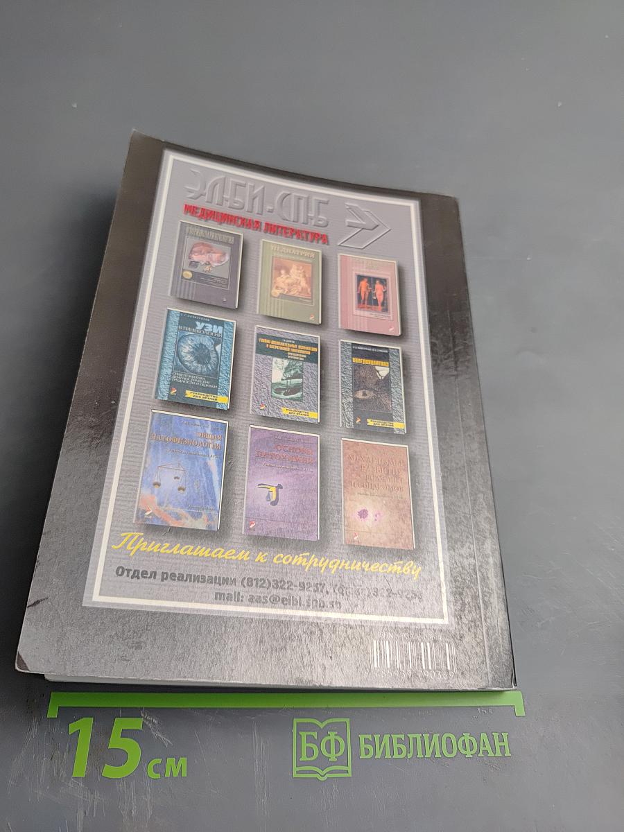 Рассеянный склероз