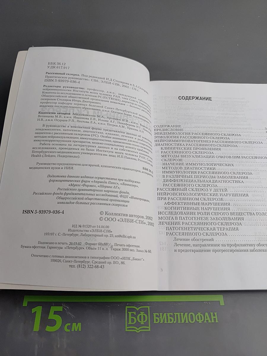 Рассеянный склероз