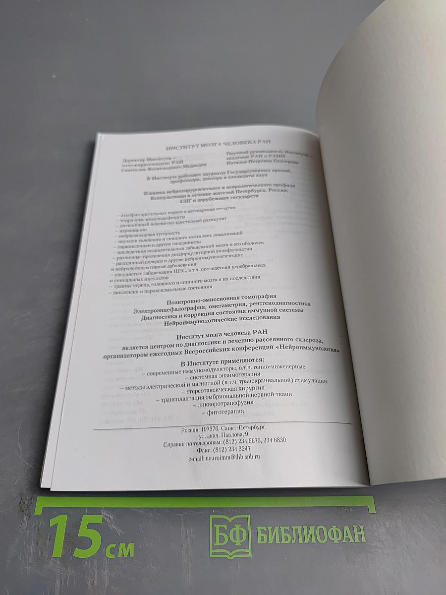 Рассеянный склероз