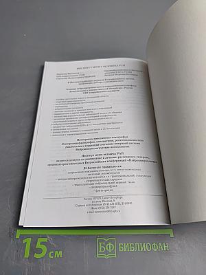 Рассеянный склероз