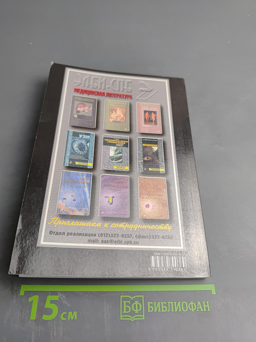 Рассеянный склероз