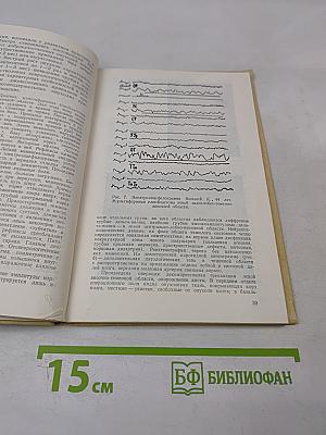 Джексоновский припадок