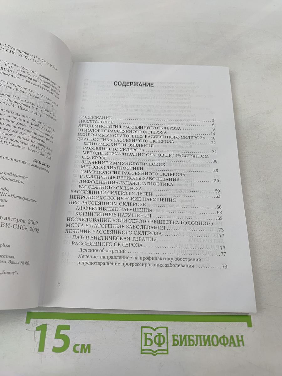 Рассеянный склероз