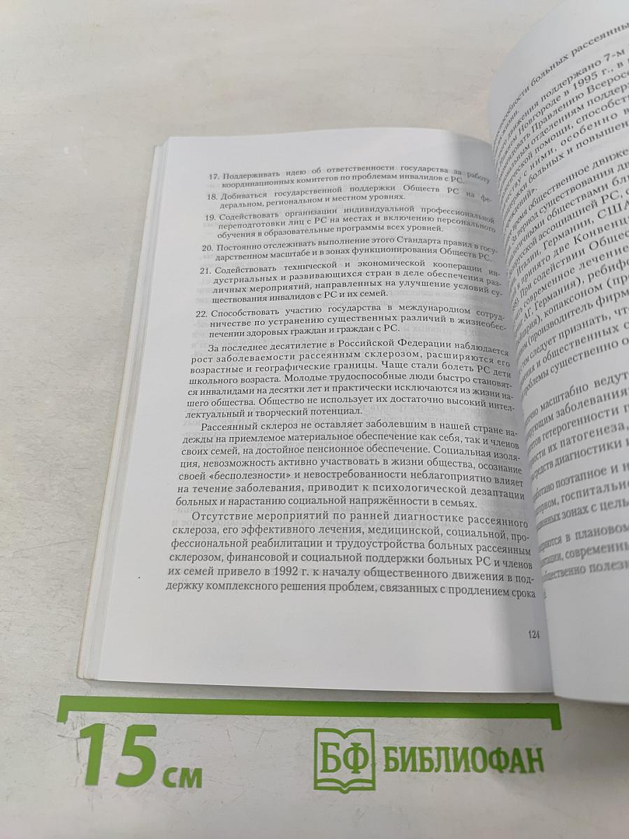 Рассеянный склероз