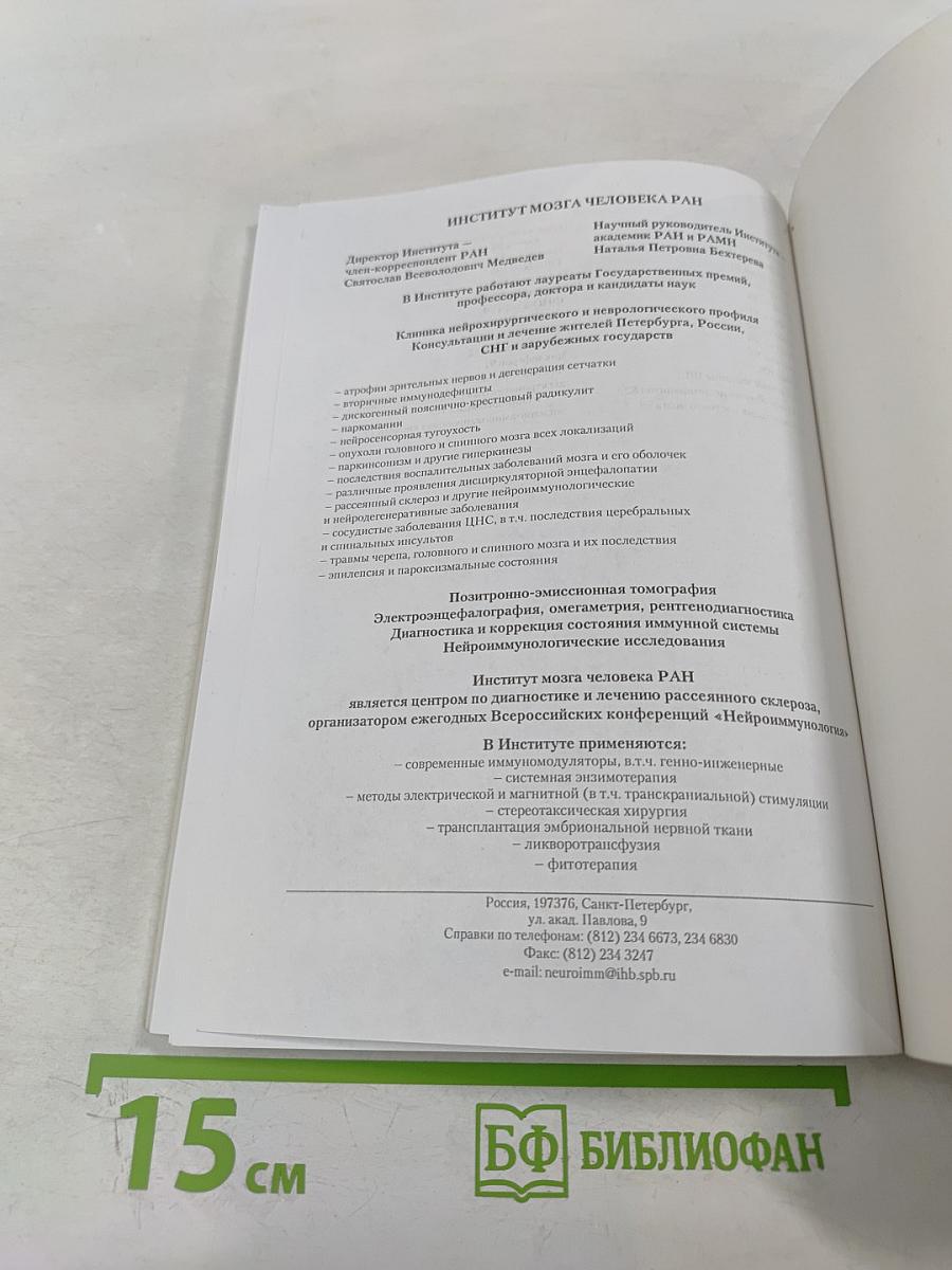 Рассеянный склероз