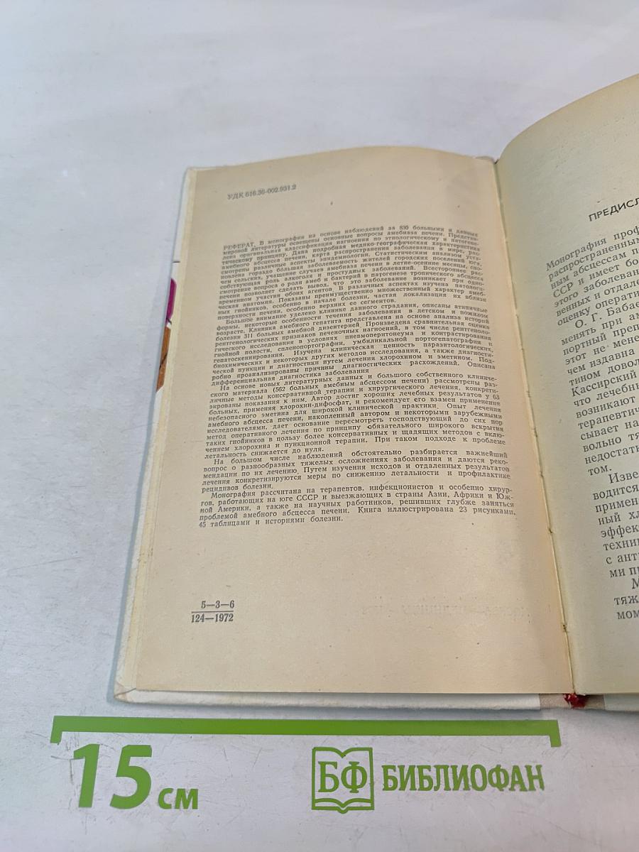 Амебный абсцесс печени