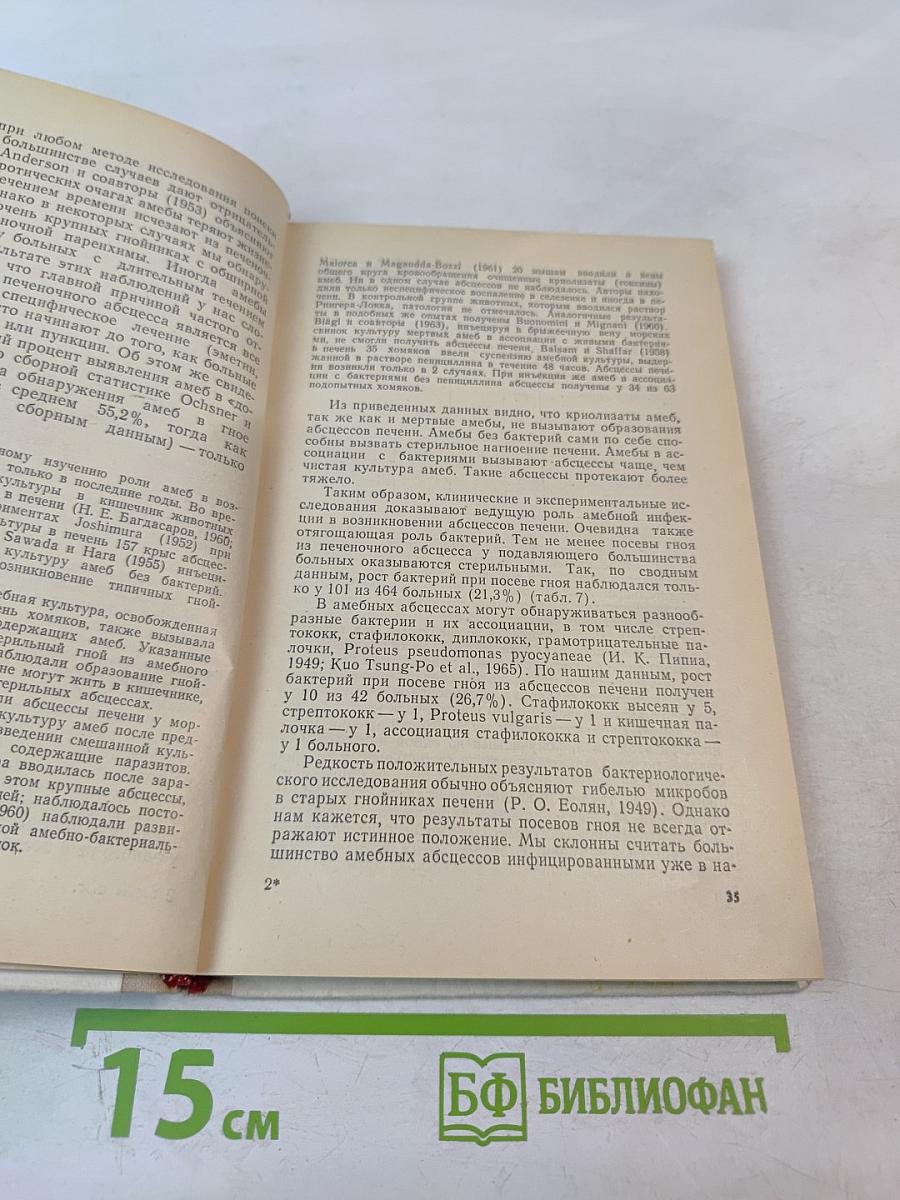 Амебный абсцесс печени