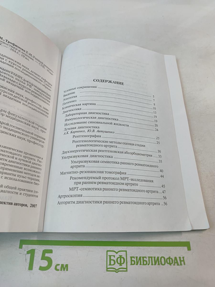 Ранний ревматоидный артрит: Принципы диагностики и лечения