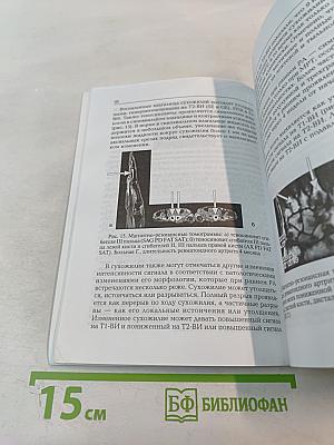 Ранний ревматоидный артрит: Принципы диагностики и лечения