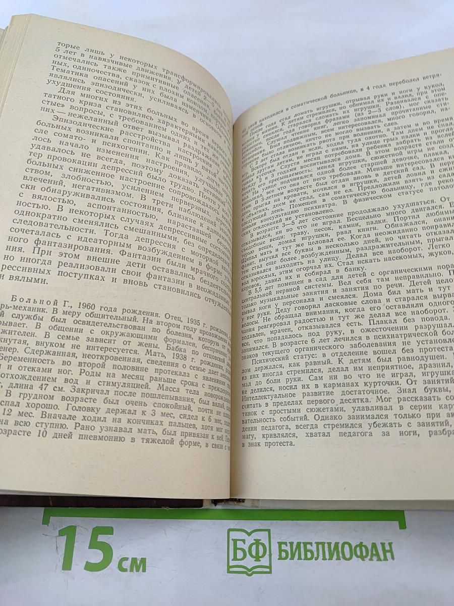 Ранняя детская шизофрения (статика и динамика)