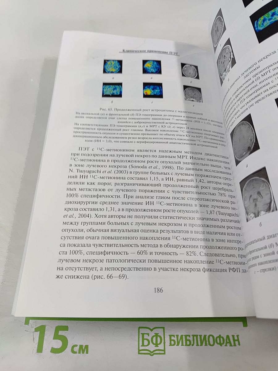 ПЭТ в России: Позитронно-эмиссионная томография в клинике и физиологии