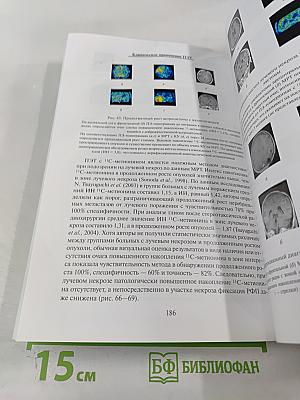ПЭТ в России: Позитронно-эмиссионная томография в клинике и физиологии