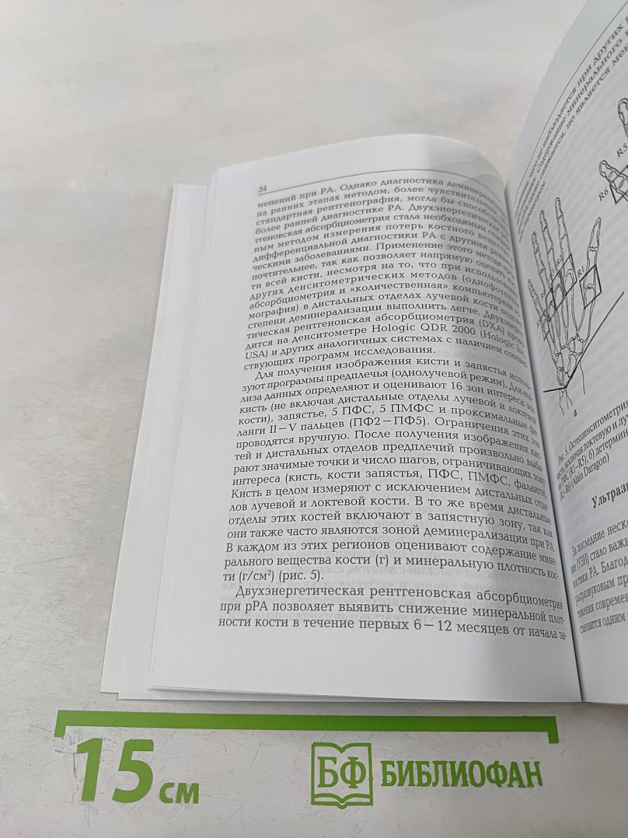 Ранний ревматоидный артрит: Принципы диагностики и лечения