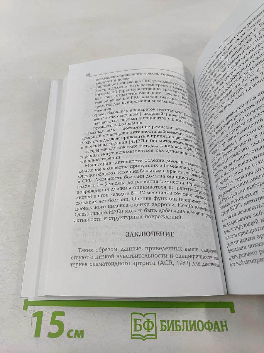 Ранний ревматоидный артрит: Принципы диагностики и лечения