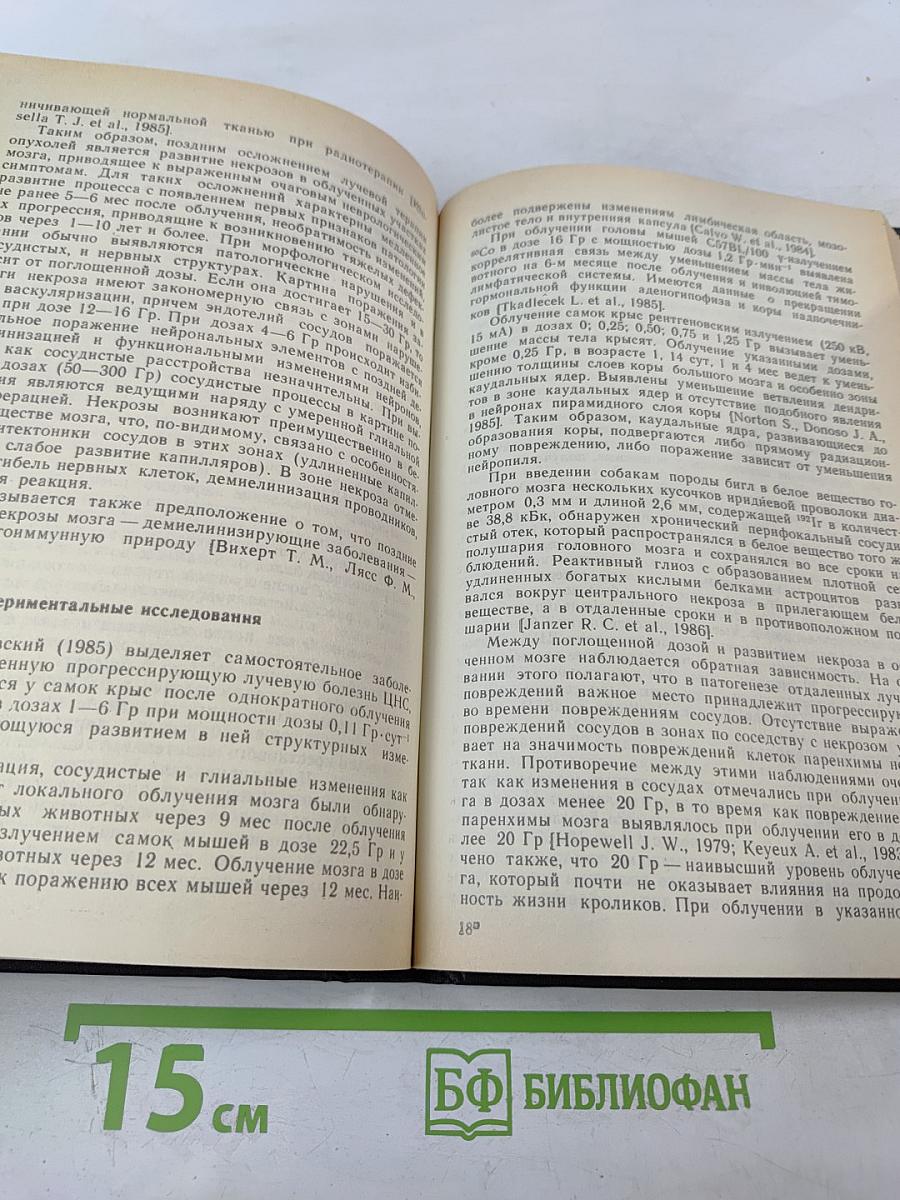 Отдаленные последствия воздействия ионизирующих излучений