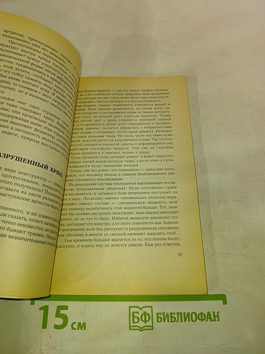 Как справиться с артритом артрозом