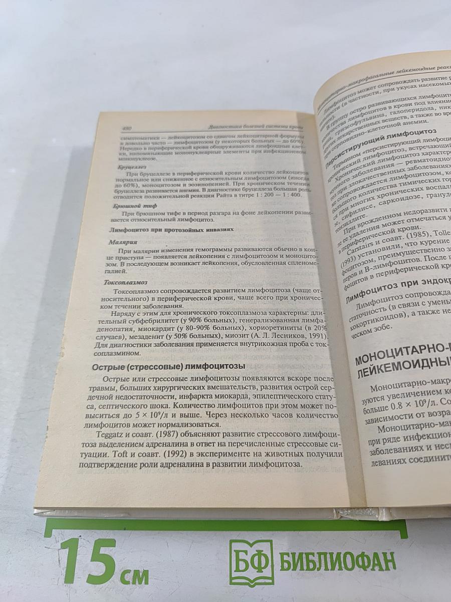 Руководство: Диагностика болезней внутренних органов. Том 4: Диагностика болезней системы крови