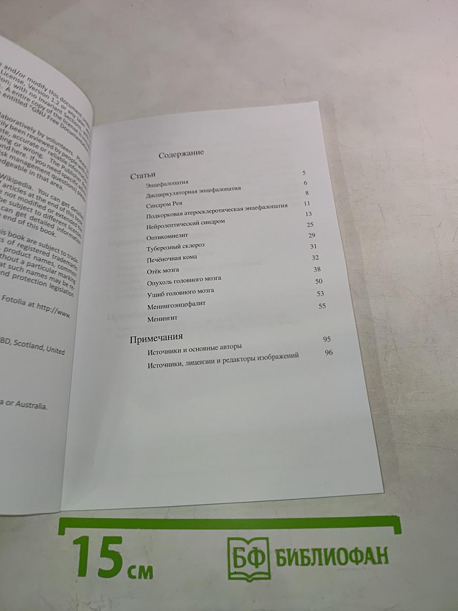 Энцефалопатия