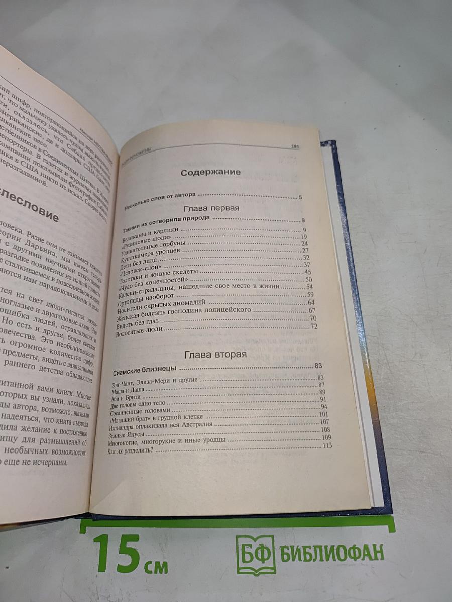 Люди-феномены