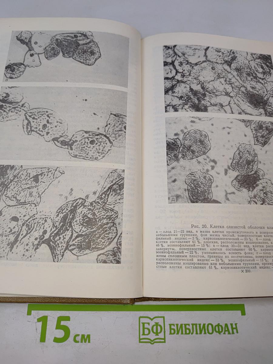 Гинекология детей и подростков