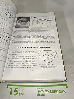 УЗИ в гинекологии. Симптоматика, диагностические трудности и ошибки